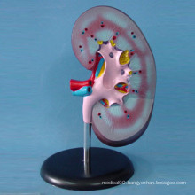 Medical Teaching Human Kidney Anatomic Model (R110101)